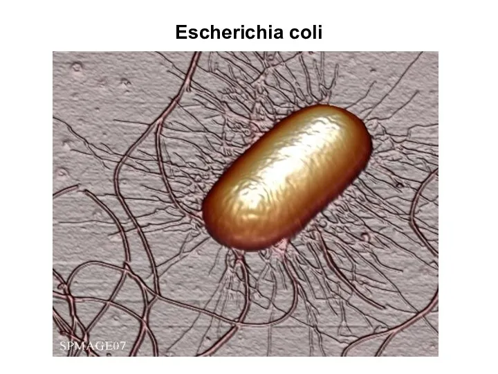 Escherichia coli