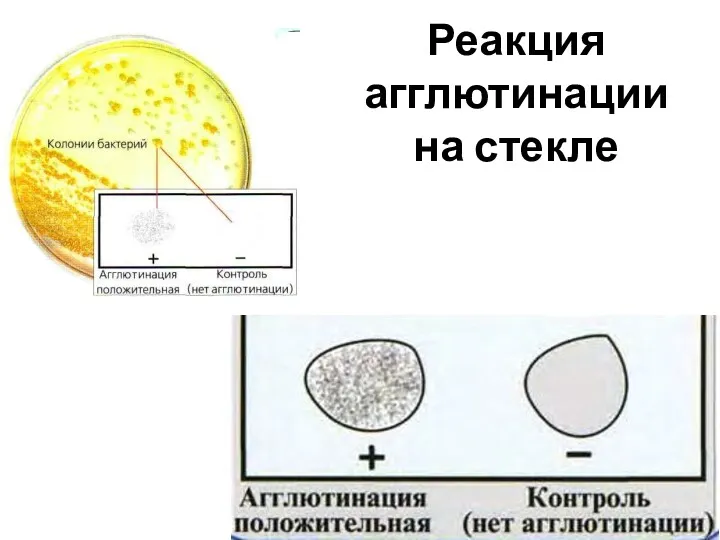 Реакция агглютинации на стекле