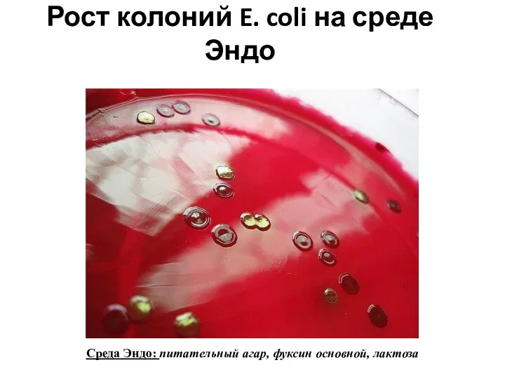 Рост колоний E. coli на среде Эндо Среда Эндо: питательный агар, фуксин основной, лактоза