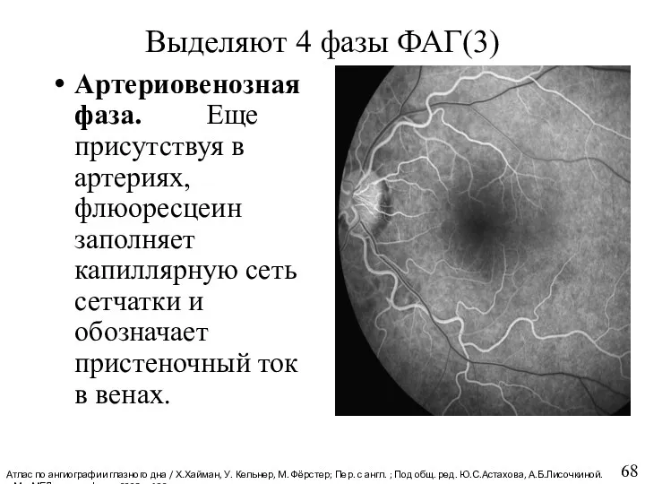 Выделяют 4 фазы ФАГ(3) Артериовенозная фаза. Еще присутствуя в артериях,