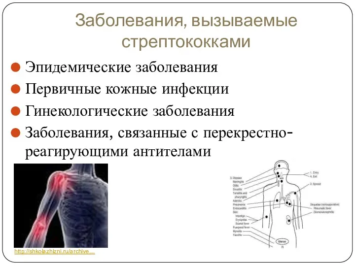 Заболевания, вызываемые стрептококками Эпидемические заболевания Первичные кожные инфекции Гинекологические заболевания Заболевания, связанные с перекрестно-реагирующими антителами http://shkolazhizni.ru/archive…