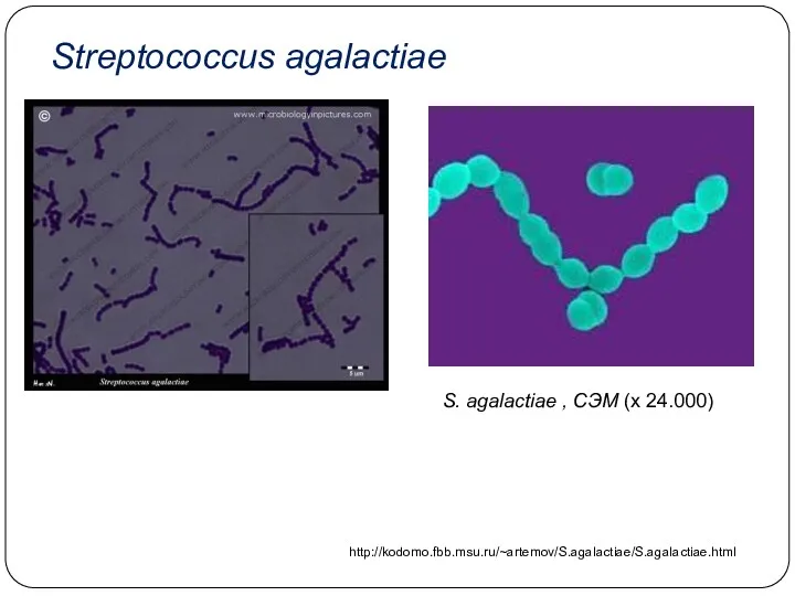 S. agalactiae , СЭМ (х 24.000) http://kodomo.fbb.msu.ru/~artemov/S.agalactiae/S.agalactiae.html Streptococcus agalactiae