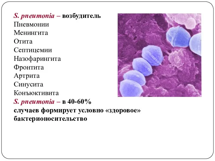 S. pneumonia – возбудитель Пневмонии Менингита Отита Септицемии Назофарингита Фронтита