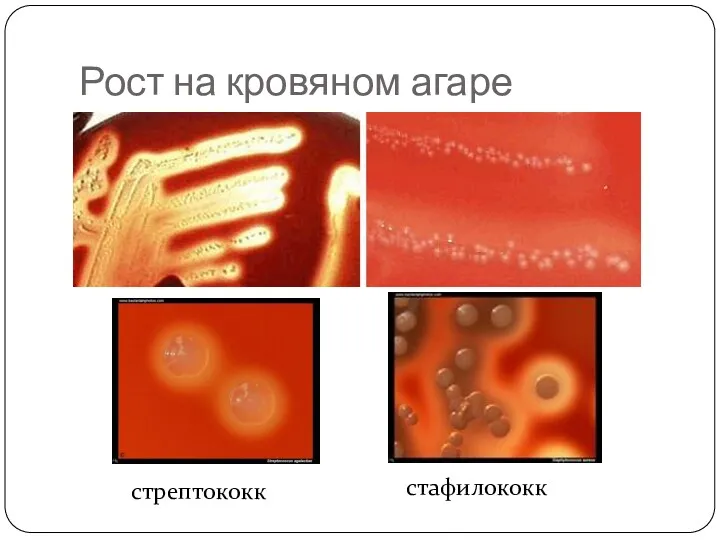 Рост на кровяном агаре стафилококк стрептококк