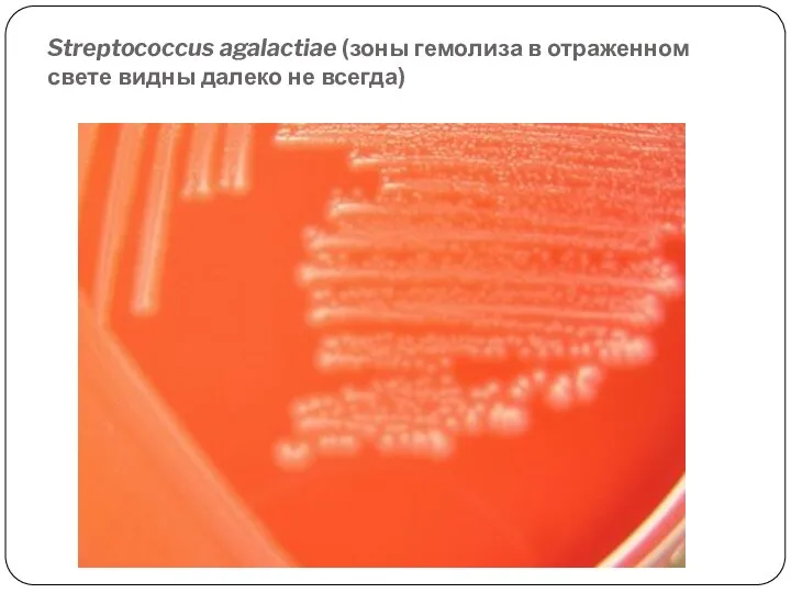 Streptococcus agalactiae (зоны гемолиза в отраженном свете видны далеко не всегда)