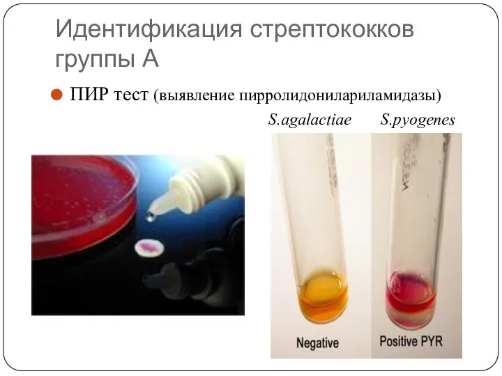 Идентификация стрептококков группы А ПИР тест (выявление пирролидонилариламидазы) S.agalactiae S.pyogenes