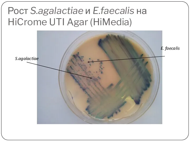 Рост S.agalactiae и E.faecalis на HiCrome UTI Agar (HiMedia) S.agalactiae E. faecalis