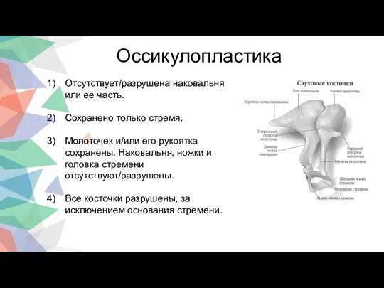 1 2 3 4 Оссикулопластика Отсутствует/разрушена наковальня или ее часть.