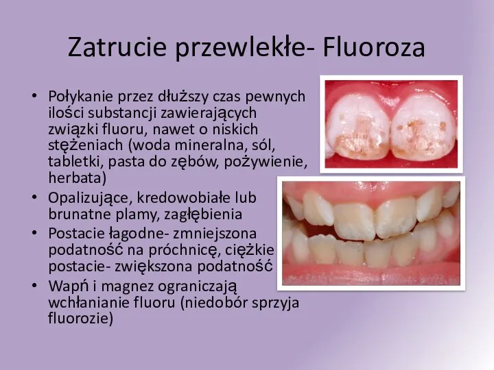 Zatrucie przewlekłe- Fluoroza Połykanie przez dłuższy czas pewnych ilości substancji zawierających związki fluoru,