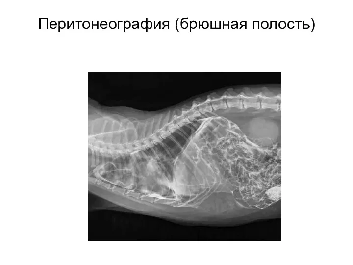 Перитонеография (брюшная полость)