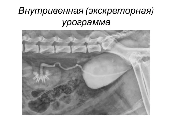 Внутривенная (экскреторная) урограмма