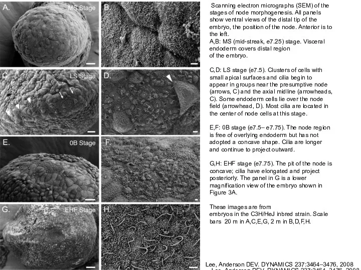 Scanning electron micrographs (SEM) of the stages of node morphogenesis.