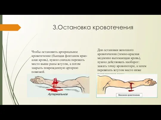 3.Остановка кровотечения Чтобы остановить артериальное кровотечение (бьющая фонтаном ярко-алая кровь),