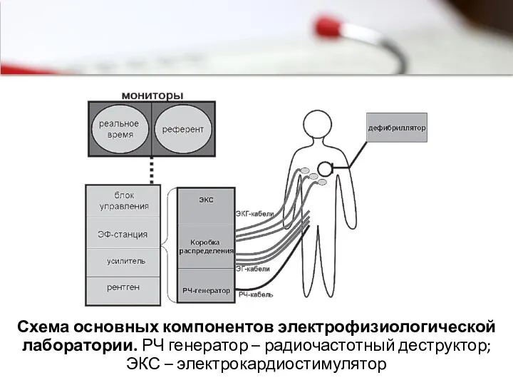 Схема основных компонентов электрофизиологической лаборатории. РЧ генератор – радиочастотный деструктор; ЭКС – электрокардиостимулятор