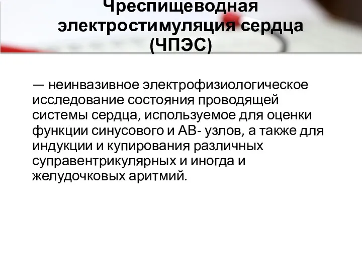 Чреспищеводная электростимуляция сердца (ЧПЭС) — неинвазивное электрофизиологическое исследование состояния проводящей