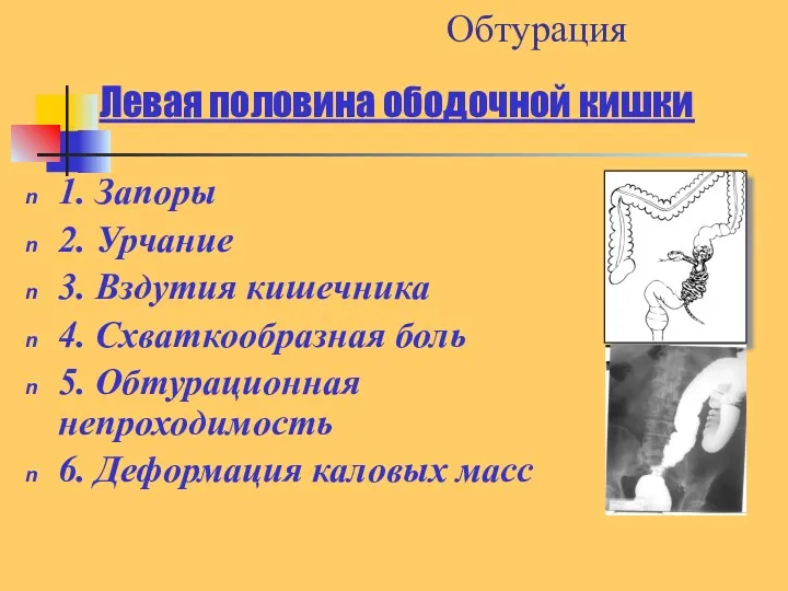 Левая половина ободочной кишки 1. Запоры 2. Урчание 3. Вздутия