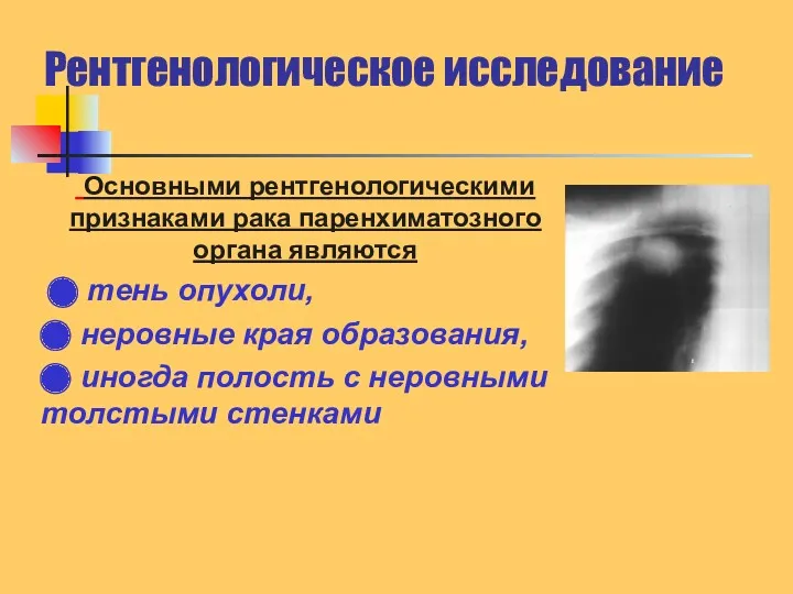 Рентгенологическое исследование Основными рентгенологическими признаками рака паренхиматозного органа являются ⬤