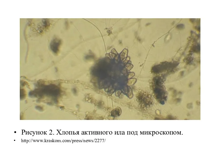 Рисунок 2. Хлопья активного ила под микроскопом. http://www.kraskom.com/press/news/2277/