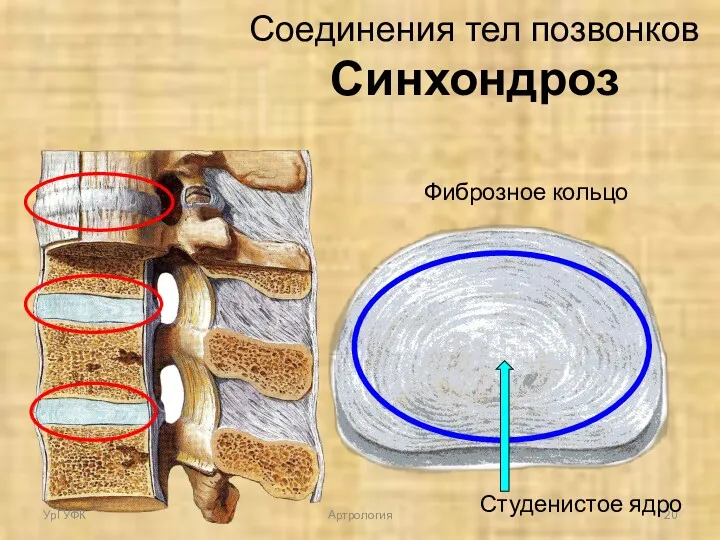 Соединения тел позвонков Синхондроз Фиброзное кольцо Студенистое ядро УрГУФК Артрология