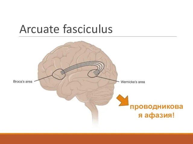 Arcuate fasciculus проводниковая афазия!