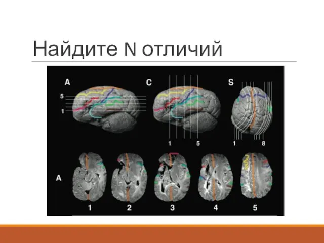 Найдите N отличий