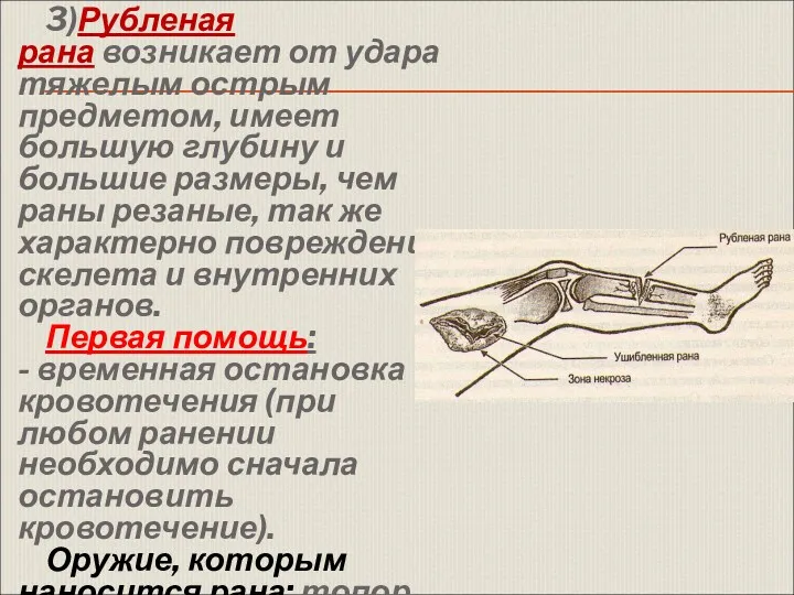 3)Рубленая рана возникает от удара тяжелым острым предметом, имеет большую