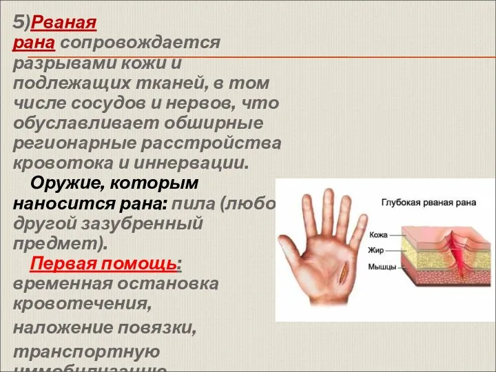 5)Рваная рана сопровождается разрывами кожи и подлежащих тканей, в том