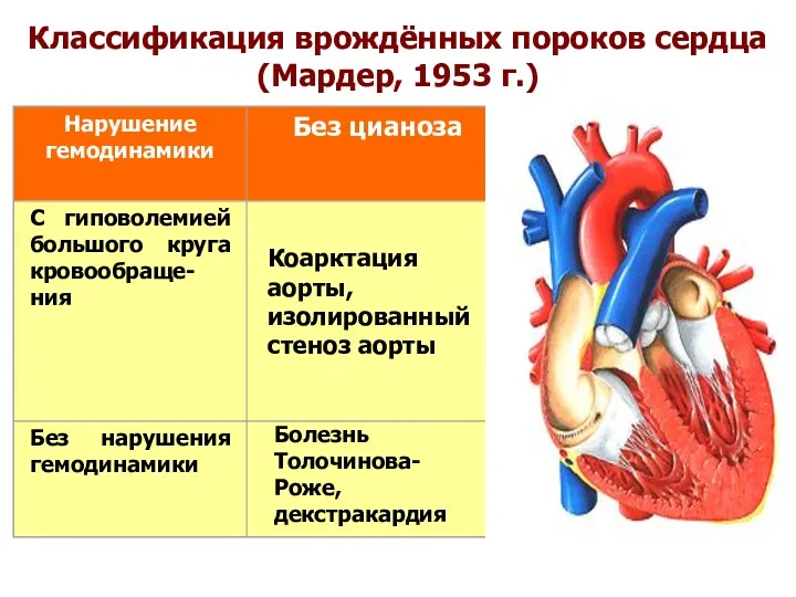 Классификация врождённых пороков сердца (Мардер, 1953 г.) Коарктация аорты, изолированный стеноз аорты Болезнь Толочинова-Роже, декстракардия