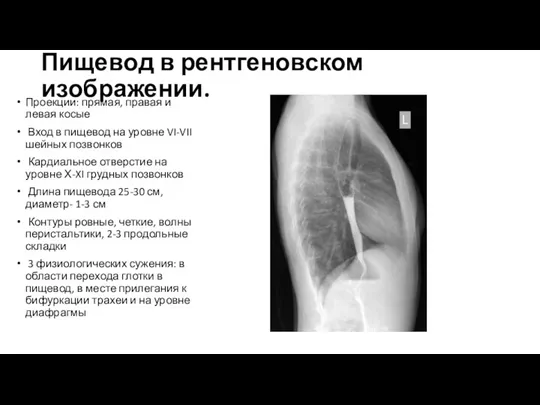 Пищевод в рентгеновском изображении. Проекции: прямая, правая и левая косые Вход в пищевод
