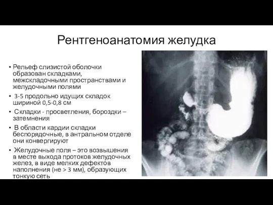 Рентгеноанатомия желудка Рельеф слизистой оболочки образован складками, межскладочными пространствами и желудочными полями 3-5