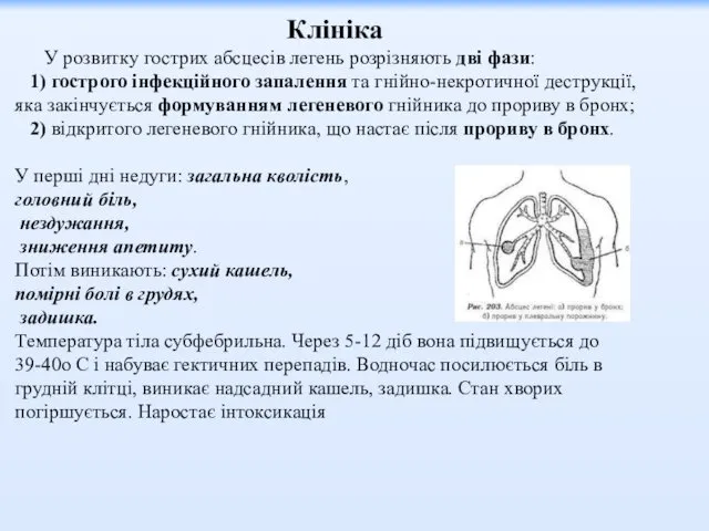 Клініка У розвитку гострих абсцесів легень розрізняють дві фази: 1)