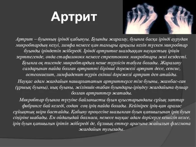 Артрит Артрит – буынның ірінді қабынуы. Буынды жаралау, буынға басқа