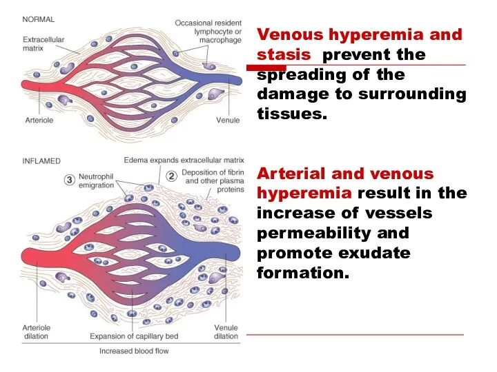 Venous hyperemia and stasis prevent the spreading of the damage
