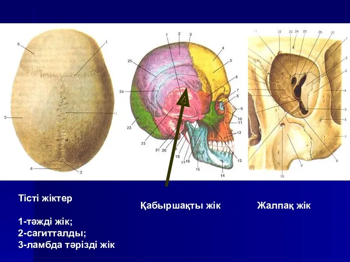 Тісті жіктер 1-тәжді жік; 2-сагитталды; 3-ламбда тәрізді жік Қабыршақты жік Жалпақ жік