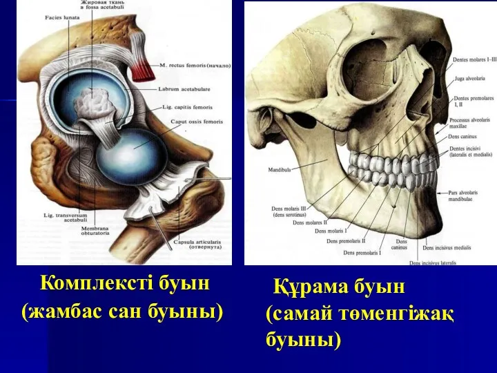 Комплексті буын (жамбас сан буыны) Құрама буын (самай төменгіжақ буыны)