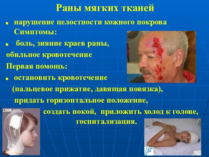 Раны мягких тканей нарушение целостности кожного покрова Симптомы: боль, зияние