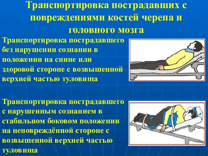 Транспортировка пострадавших с повреждениями костей черепа и головного мозга Транспортировка