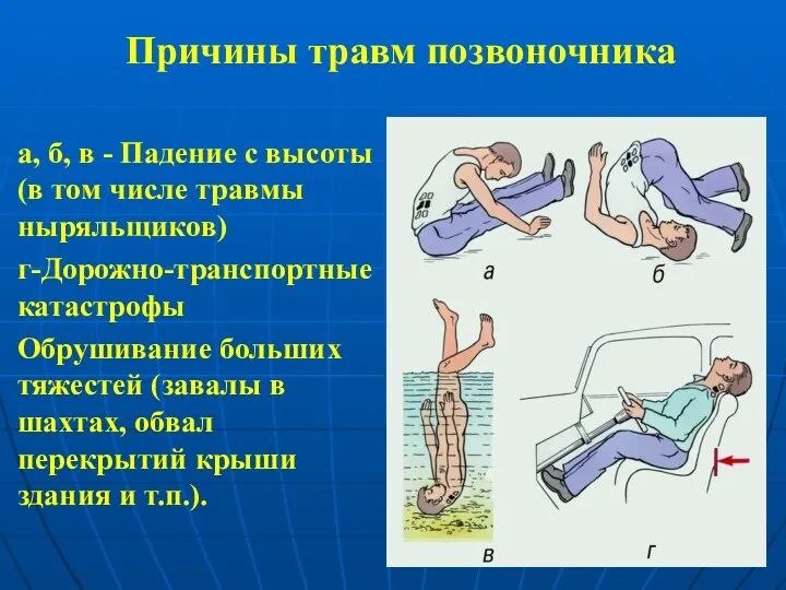 Причины травм позвоночника а, б, в - Падение с высоты