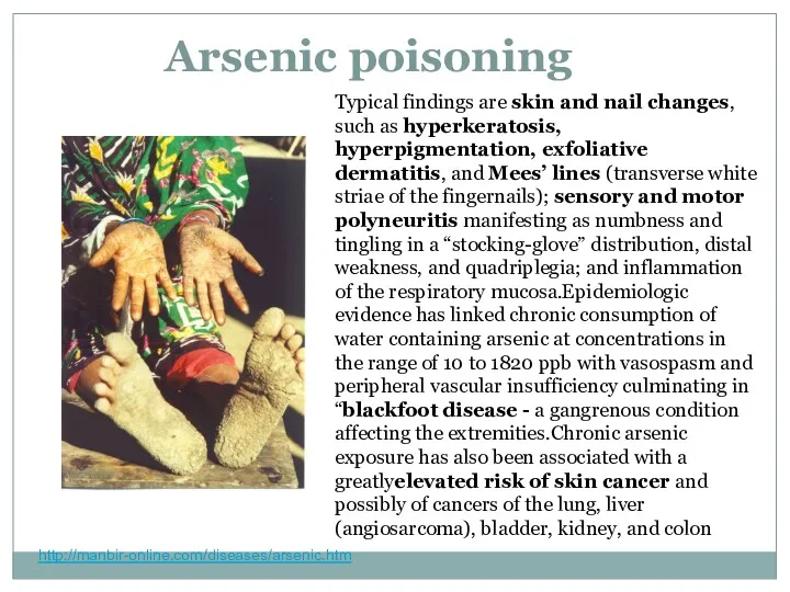 Arsenic poisoning http://manbir-online.com/diseases/arsenic.htm Typical findings are skin and nail changes, such as hyperkeratosis,