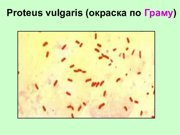 Proteus vulgaris (окраска по Граму)