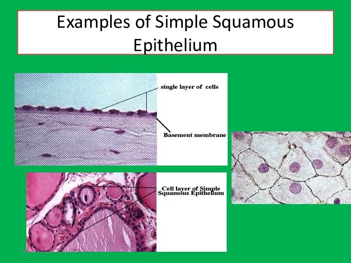 Jenna Hellack Jan 2001 Examples of Simple Squamous Epithelium