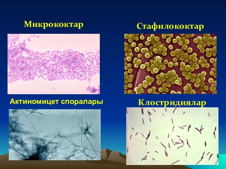 Актиномицет споралары Клостридиялар Стафилококтар Микрококтар