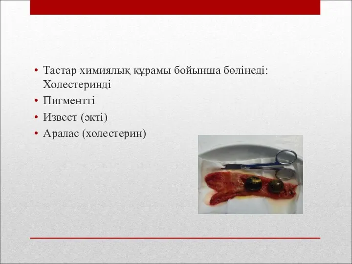 Тастар химиялық құрамы бойынша бөлінеді: Холестеринді Пигментті Извест (әкті) Аралас (холестерин)