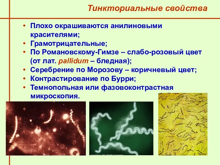 Тинкториальные свойства Плохо окрашиваются анилиновыми красителями; Грамотрицательные; По Романовскому-Гимзе –