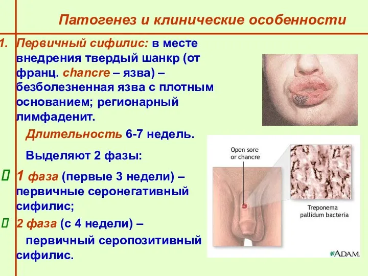 Патогенез и клинические особенности Первичный сифилис: в месте внедрения твердый