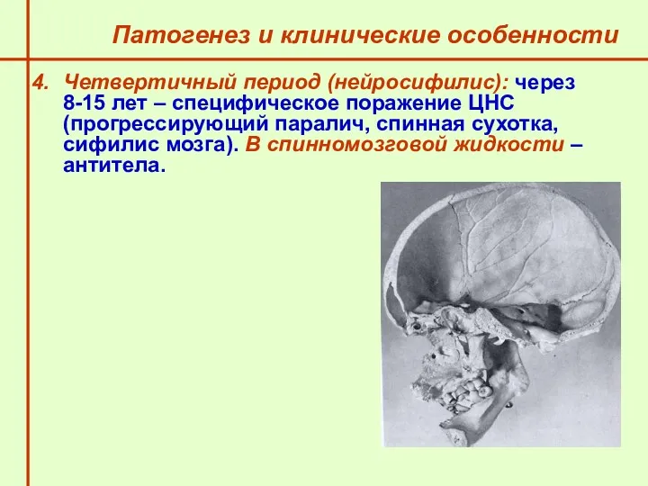 Патогенез и клинические особенности Четвертичный период (нейросифилис): через 8-15 лет