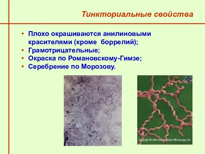 Тинкториальные свойства Плохо окрашиваются анилиновыми красителями (кроме боррелий); Грамотрицательные; Окраска по Романовскому-Гимзе; Серебрение по Морозову.