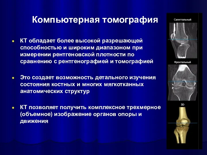 Компьютерная томография КТ обладает более высокой разрешающей способностью и широким