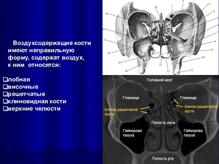 Воздухсодержащие кости имеют неправильную форму, содержат воздух, к ним относятся: