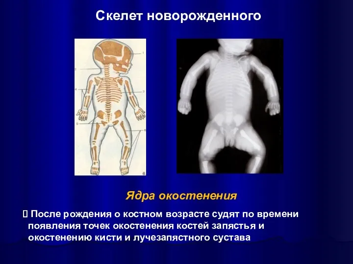 Скелет новорожденного Ядра окостенения После рождения о костном возрасте судят